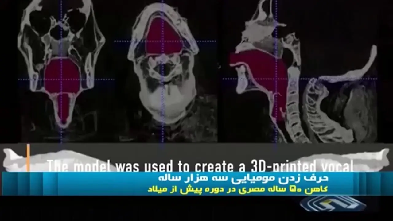 زبان باز کردن جسد مومیایی‌شده کاهن مصری بعد از ۳۰۰۰ سال+ویدیو